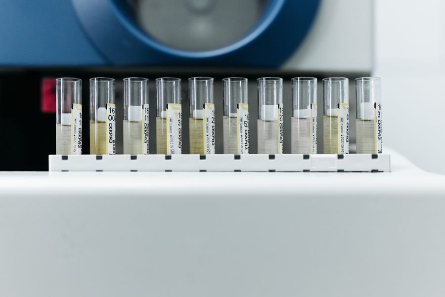 Measuring Test Automation ROI: Metrics That Actually Matter
